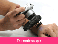 Dermatoscope